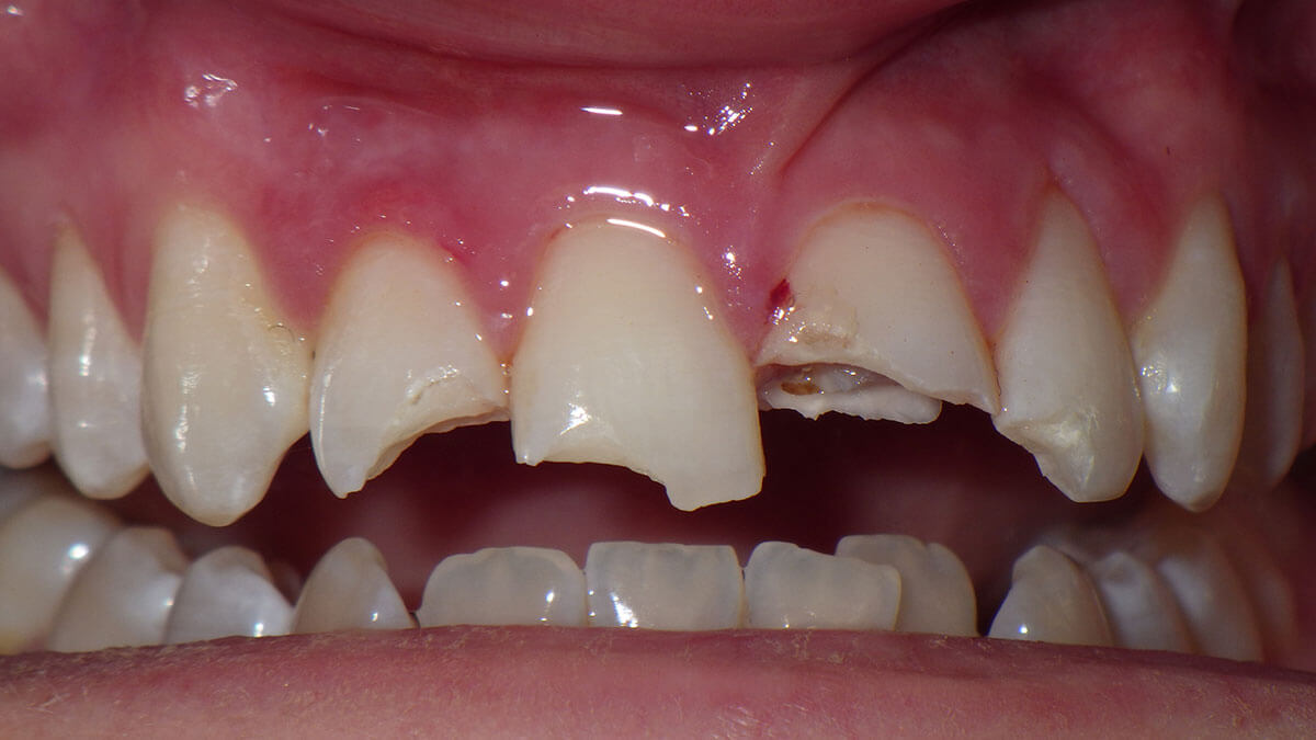 Teeth Repair Smile Gallery