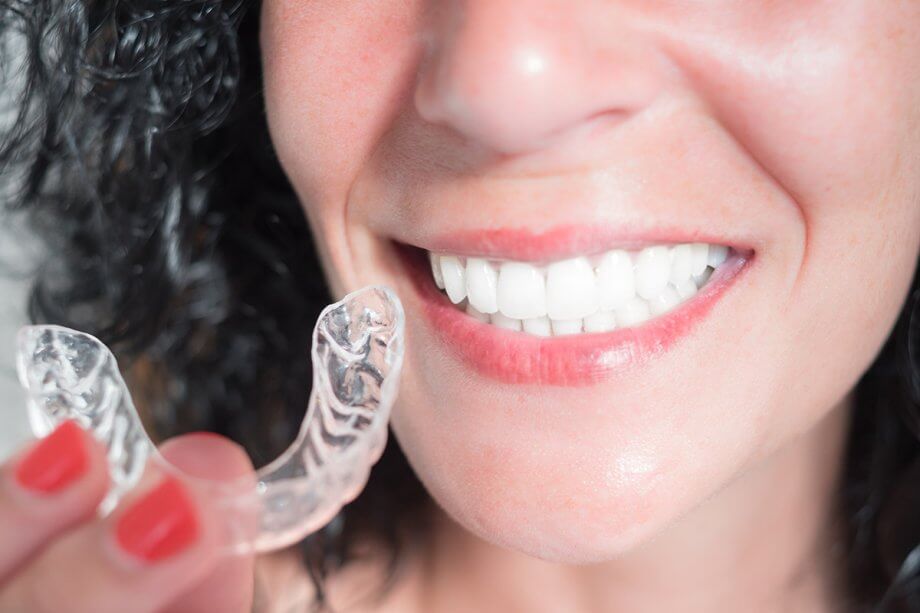 How Long Will Invisalign