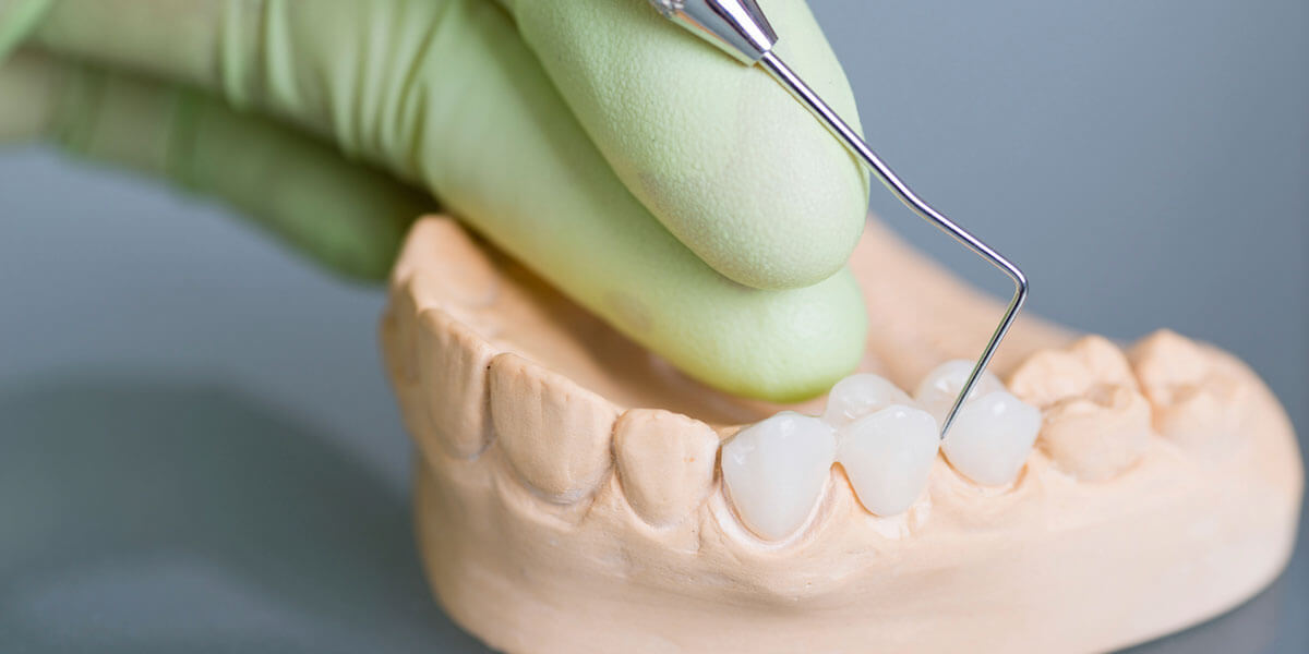 Dental Bridges in Scarsdale, NY