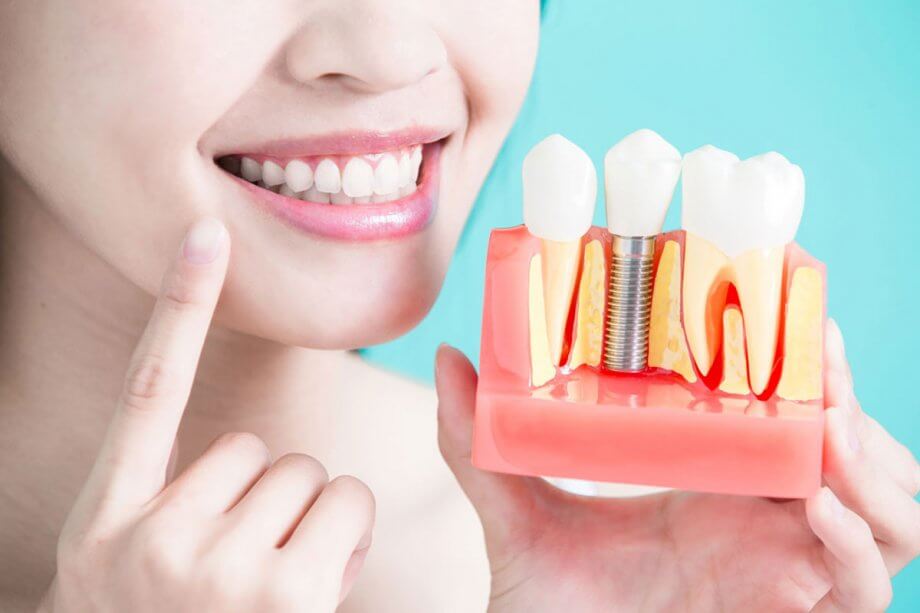 Dental Implant and Crown: Is This Combination Right for You?
