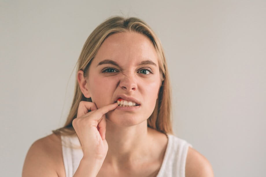 Girl With Red Gums From Gum Disease