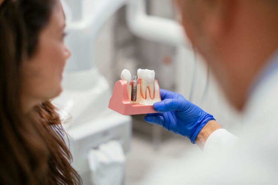 The Dental Implant Process: What to Expect at Each Stage 