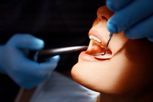 What Happens If You Skip Professional Dental Cleanings for Too Long